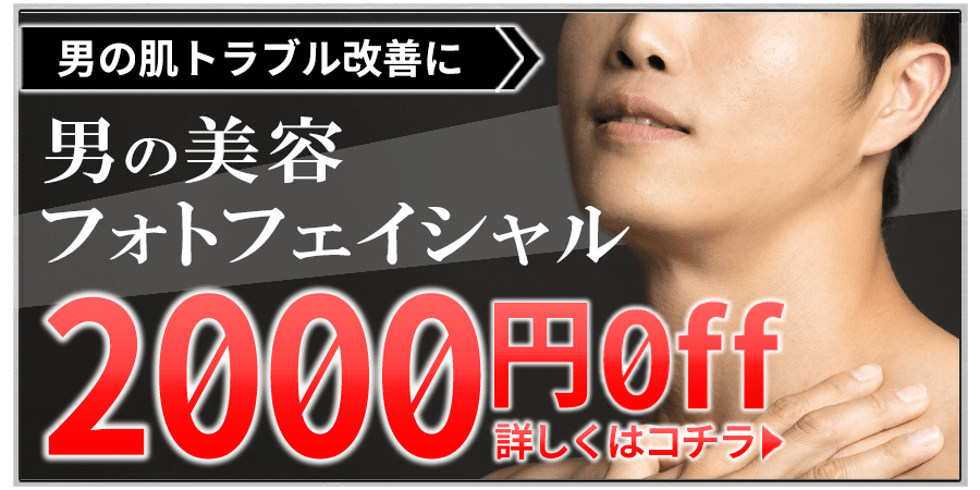 メンズ脱毛フィーゴ初回限定フォトフェイシャル2000円オフキャンペーン