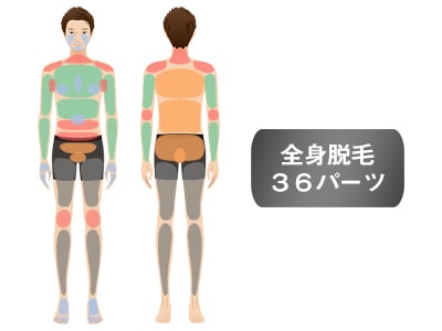 メンズ脱毛フィーゴ　おすすめ脱毛セット　全身脱毛セット